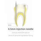 Woodpecker Fi-G Obturation Gun Tips