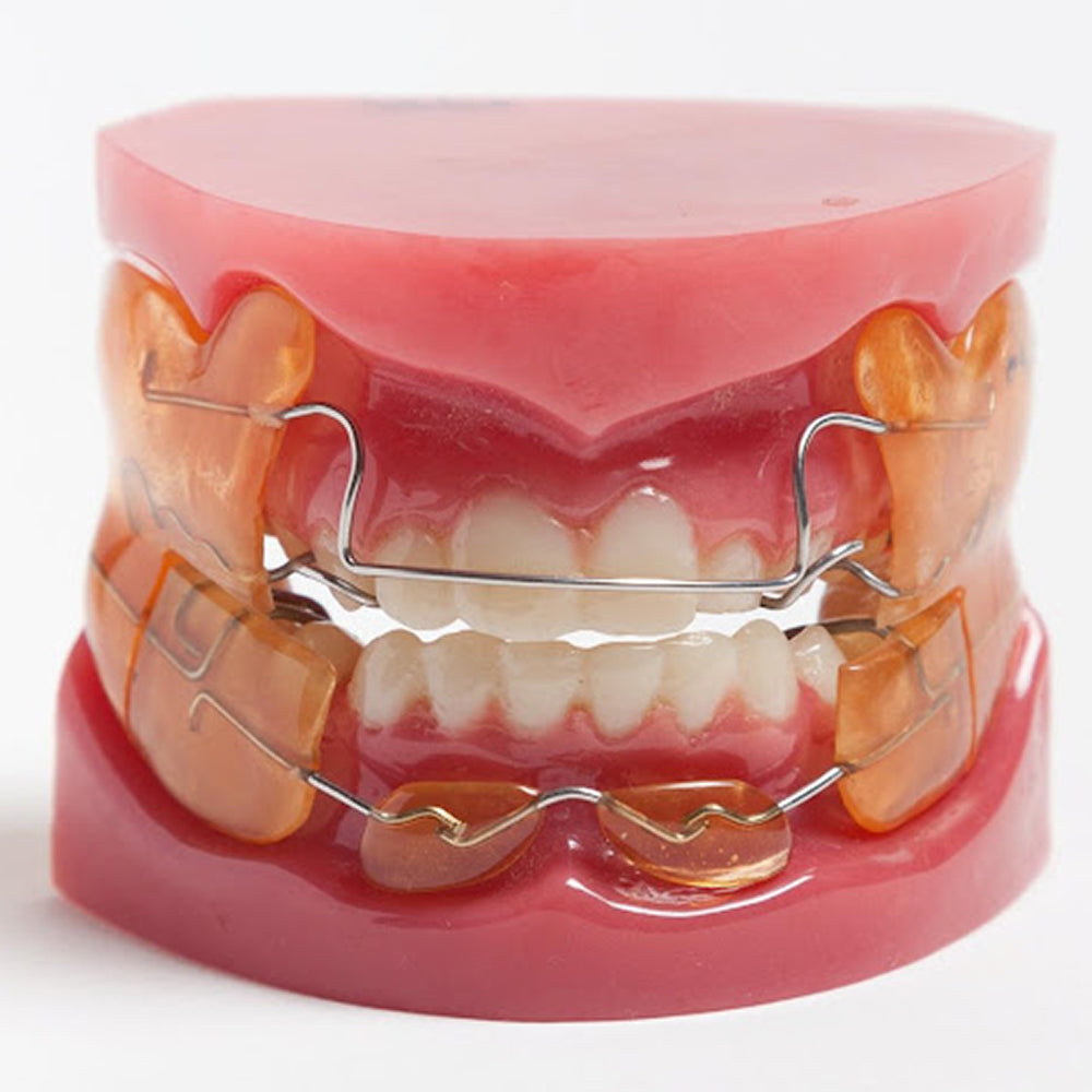 KONARK Stainless Steel Orthodontic Arch Wire – 19, 21 & 23 Gauge wire | High Strength SS Orthodontic Wire for Braces | Buy Online India