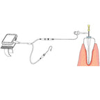 Woodpecker Apex Locator Accessories