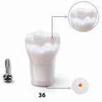 iDENTical Typodont Lower Left First Molar – #36 Nissin TJMA09
