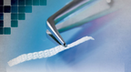 Ribbond Ribbon Fiber Splint
