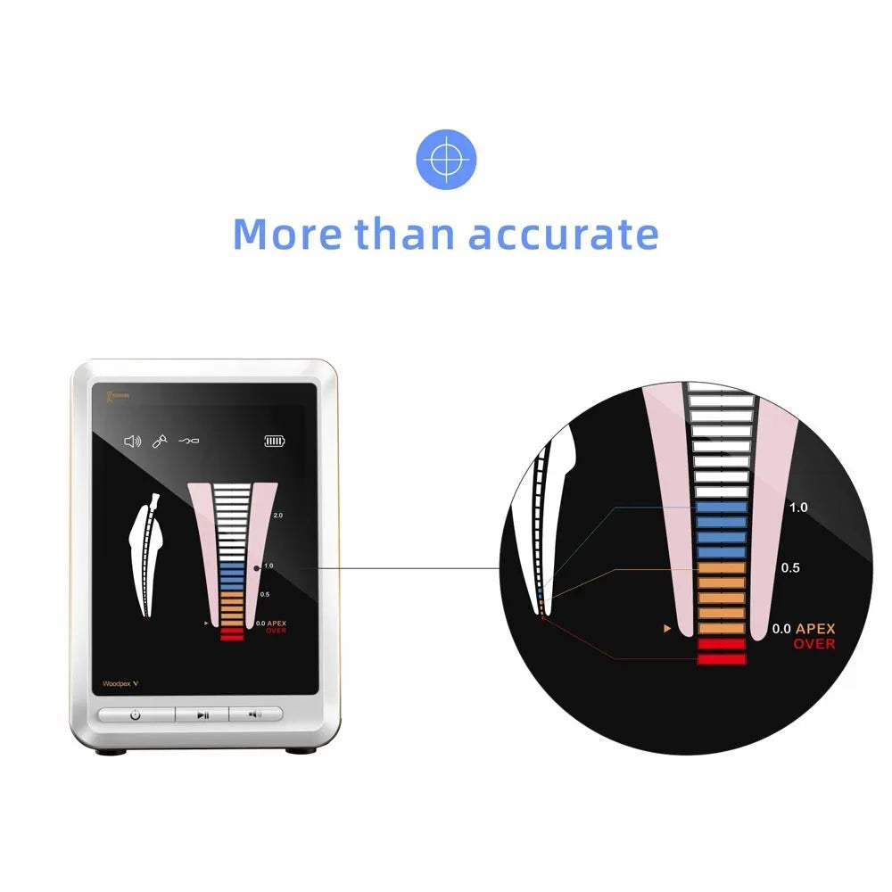 Woodpecker Woodpex Five apex locator in clinical use
