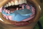 Cotisen Autoclavable Impression Trays