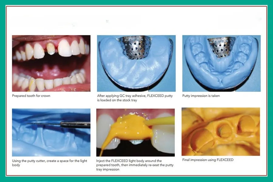 GC Flexceed Putty and Light Body Kit