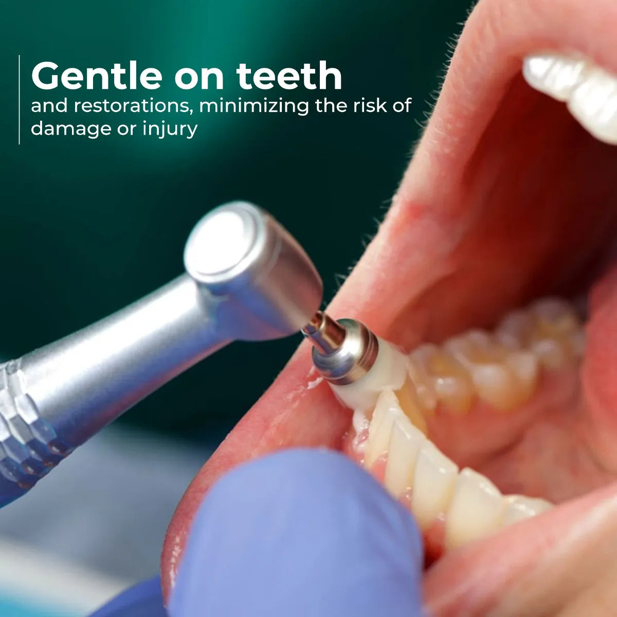 Cotisen Prophy Polishing Brushes (Pack of 100)