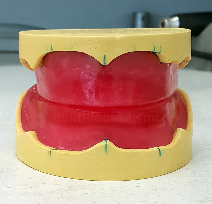 Prevest HiFlex Modelling Wax – Dental Modelling Wax Sheets for Denture Fabrication