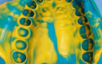 Prevest Accusil Combo Kit Dental Impression Material – High Accuracy Silicone Impression Kit