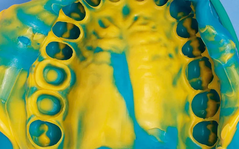 Prevest DenPro Accusil Putty – VPS Dental Impression Material for Precise Impressions