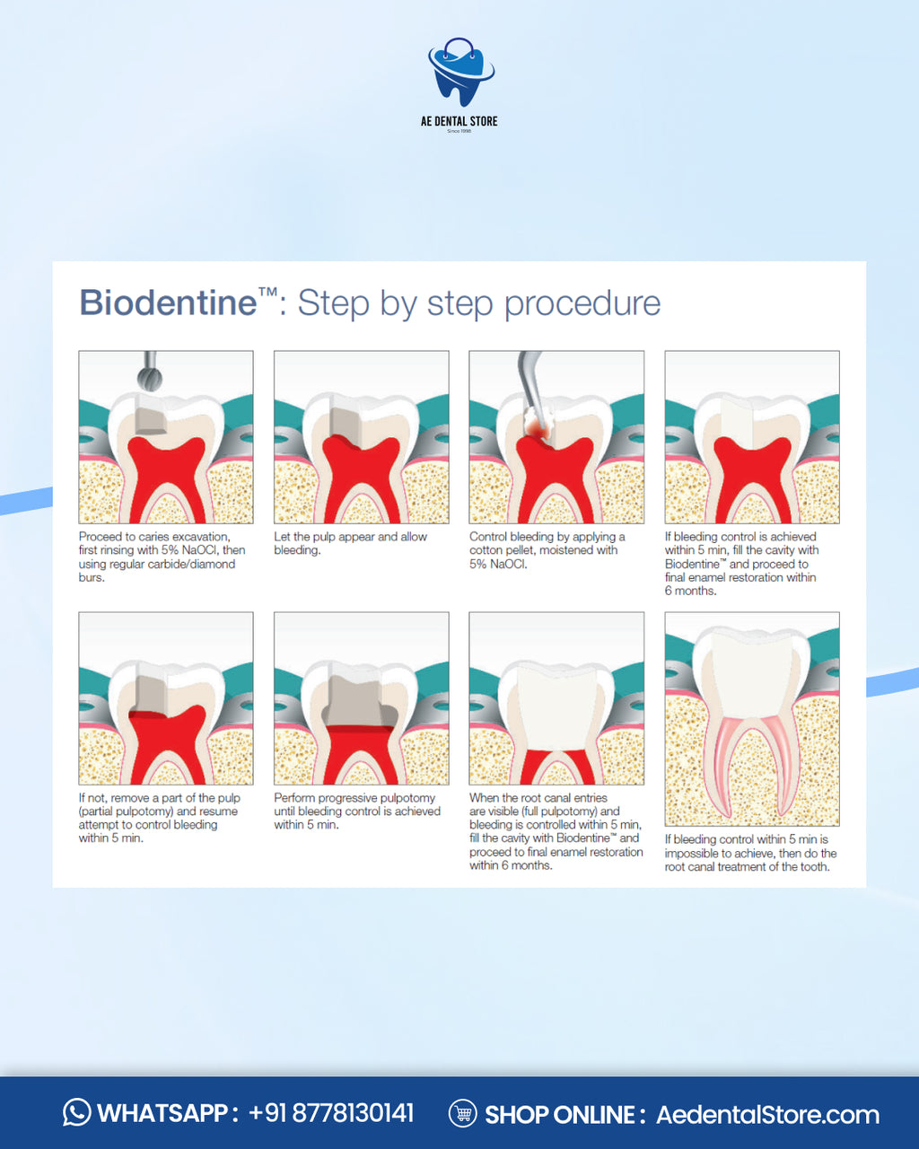 Septodont Biodentine Bioactive Dentin Substitute Kit – Pack of 5 Capsules