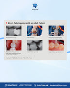 Septodont Biodentine Bioactive Dentin Substitute Kit – Pack of 5 Capsules