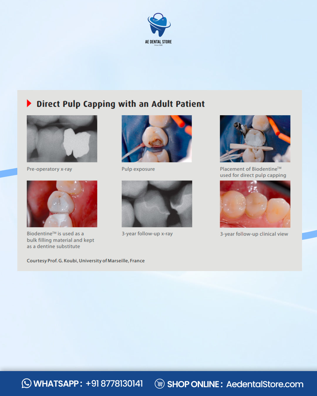 Septodont Biodentine Bioactive Dentin Substitute Kit – Pack of 5 Capsules