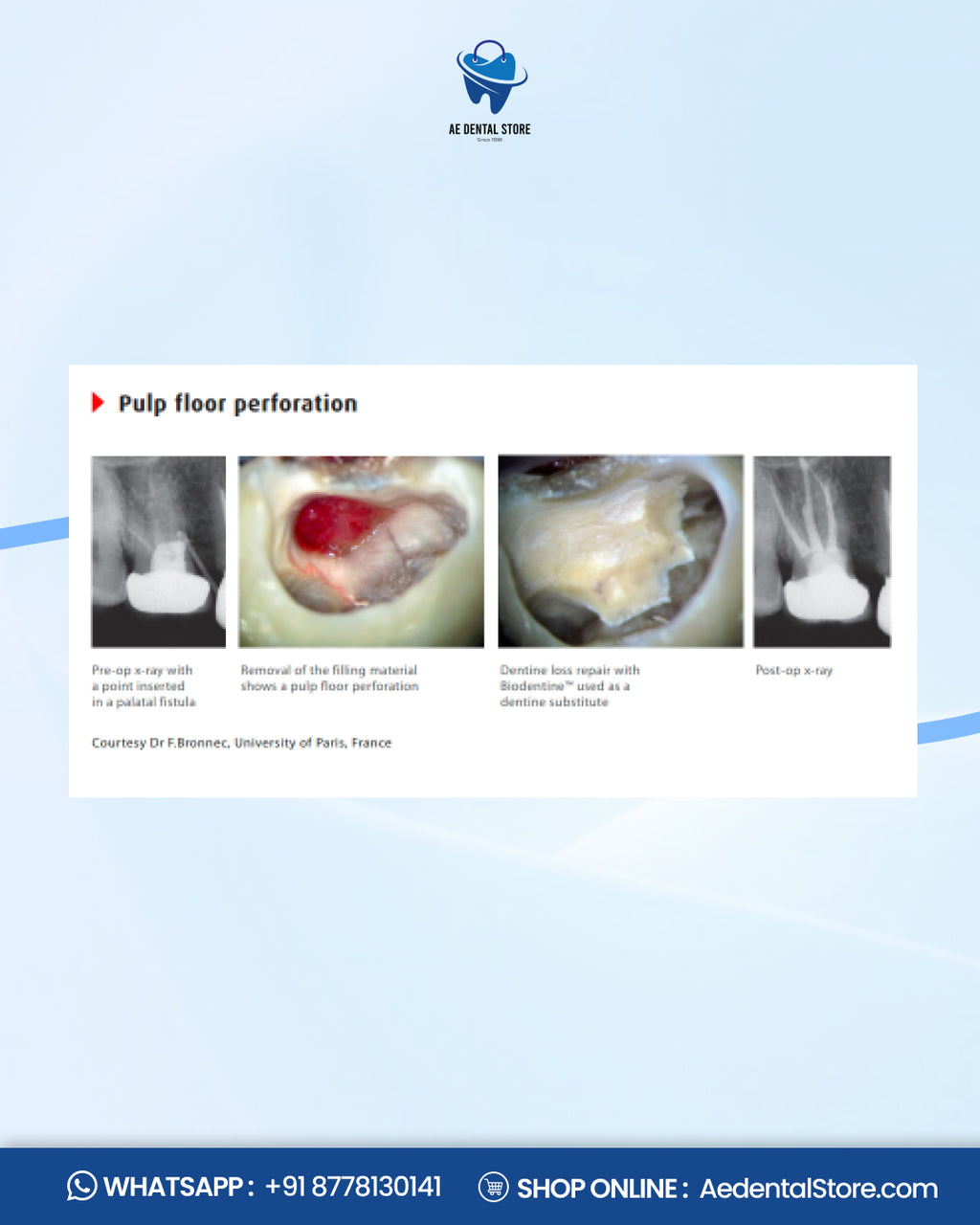 Septodont Biodentine Bioactive Dentin Substitute Kit – Pack of 5 Capsules