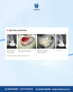 Septodont Biodentine Bioactive Dentin Substitute Kit – Pack of 5 Capsules