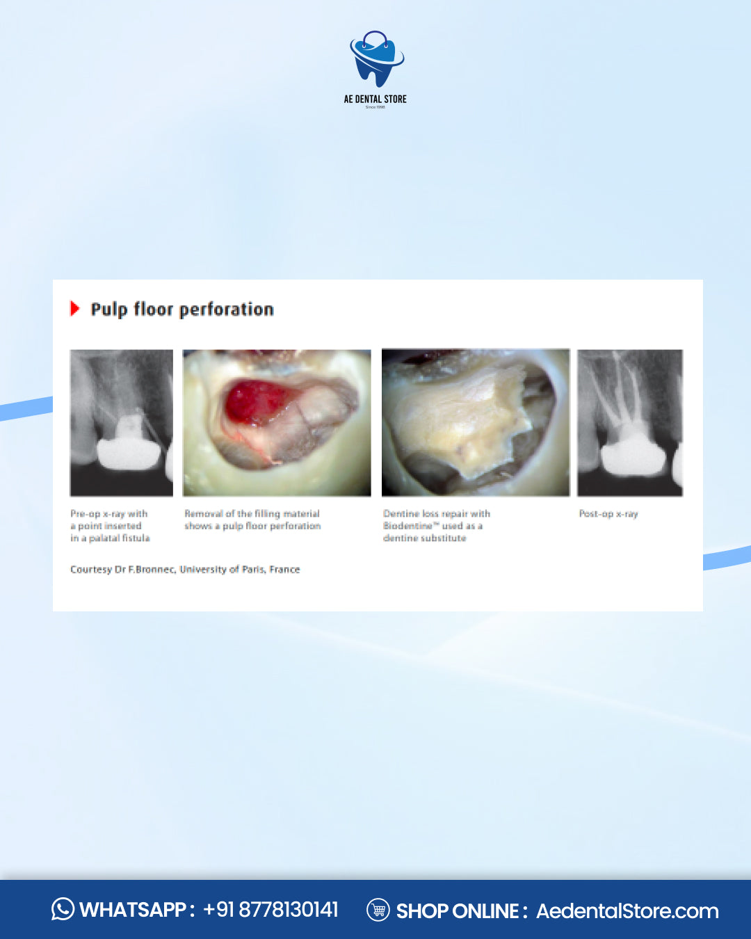 Septodont Biodentine Bioactive Dentin Substitute Kit – Pack of 5 Capsules