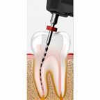 Woodpecker Endomatic 6th generation endomotor unit