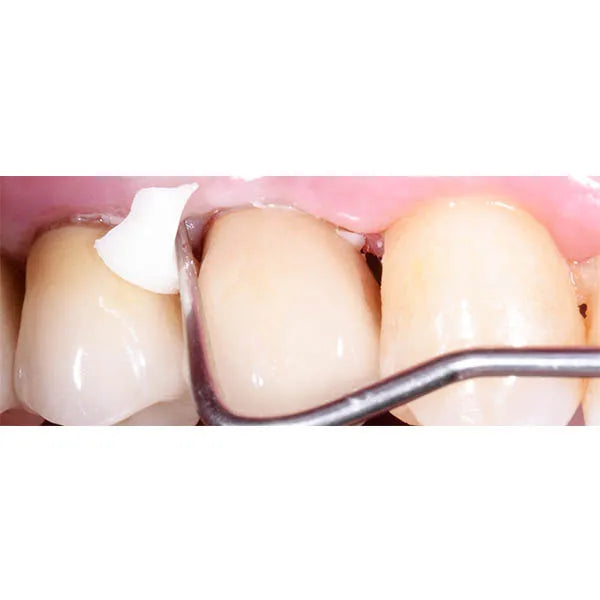 GC Gold Label 1 Luting Lining GIC