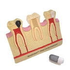 Septodont Biodentine Kit (Pack of 5 Capsules)
