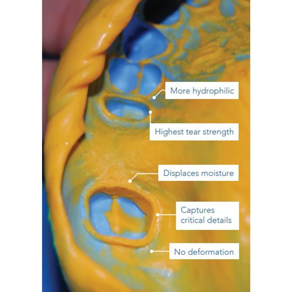 GC Flexceed Putty and Light Body Kit
