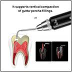 Woodpecker Fi-P Obturation Pen Tips