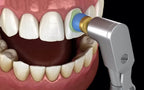 Prevest Spectra Nano Hybrid Composite – Light Cure Dental Restorative Composite