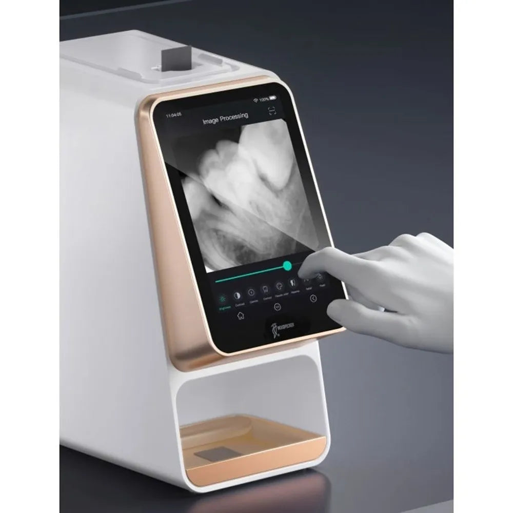 Woodpecker I-Scan intraoral scanner – in clinical use