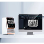 Woodpecker I-Scan intraoral scanner – software interface display