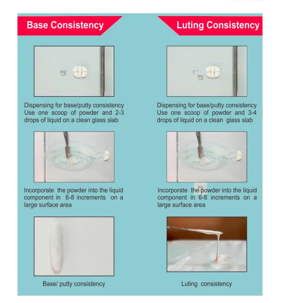 Prevest Zinc F Dental Cement – Radiopaque Luting Cement with High Strength & Marginal Adaptation