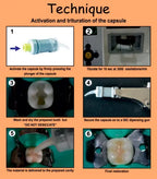 Prevest DenPro Micron Superior Capsules – Glass Ionomer Restorative Cement Capsules