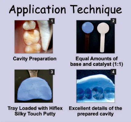 Prevest Accusil Combo Kit Dental Impression Material – High Accuracy Silicone Impression Kit