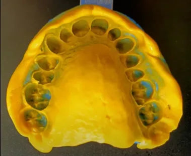 Prevest DenPro Accusil Putty – VPS Dental Impression Material for Precise Impressions