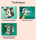 Prevest Pulp X calcium hydroxide endodontic treatment box