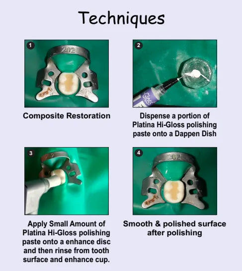 Prevest Platina Hi-Gloss Prophy Paste – Dental Polishing Paste for Stain & Plaque Removal