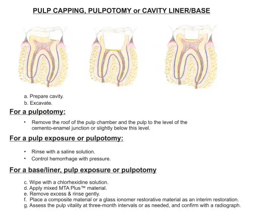 Prevest MTA Plus – Mineral Trioxide Aggregate Root Repair Cement