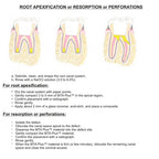 Prevest MTA Plus – Mineral Trioxide Aggregate Root Repair Cement