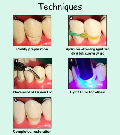 Prevest Fusion Flo Flowable Composite – Light Cure Dental Flowable Composite