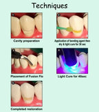 Prevest Fusion Flo Flowable Composite – Light Cure Dental Flowable Composite
