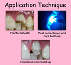 Prevest Fusion Core DC Flo Dual Cure Core Build Up Composite – 9gm
