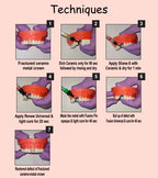 Prevest A.C.E Ceramic Repair Kit – Intraoral Porcelain Repair Kit with Silane for Strong Bonding