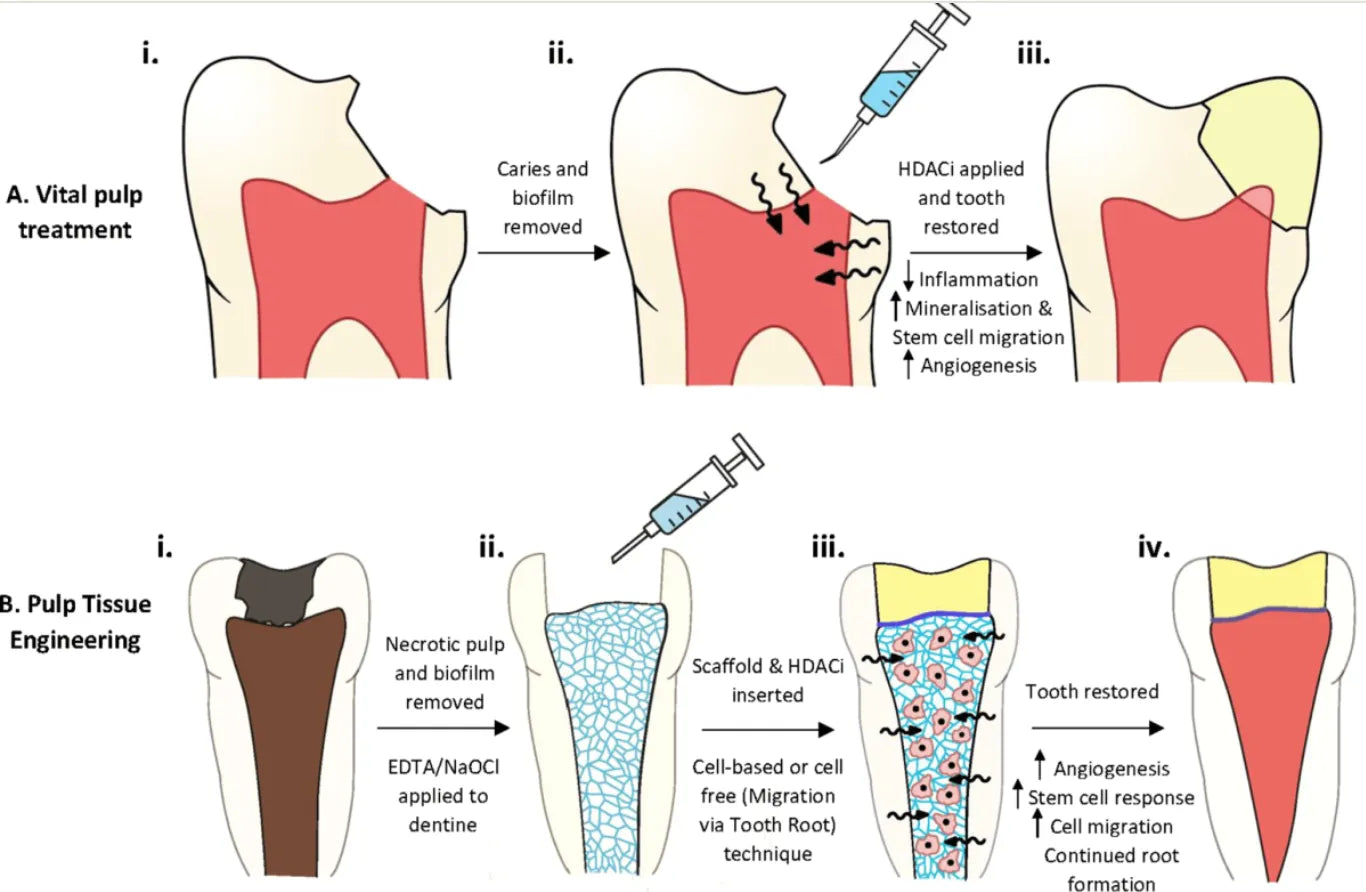 Prevest Dolo Endogel paste applied with applicator tip