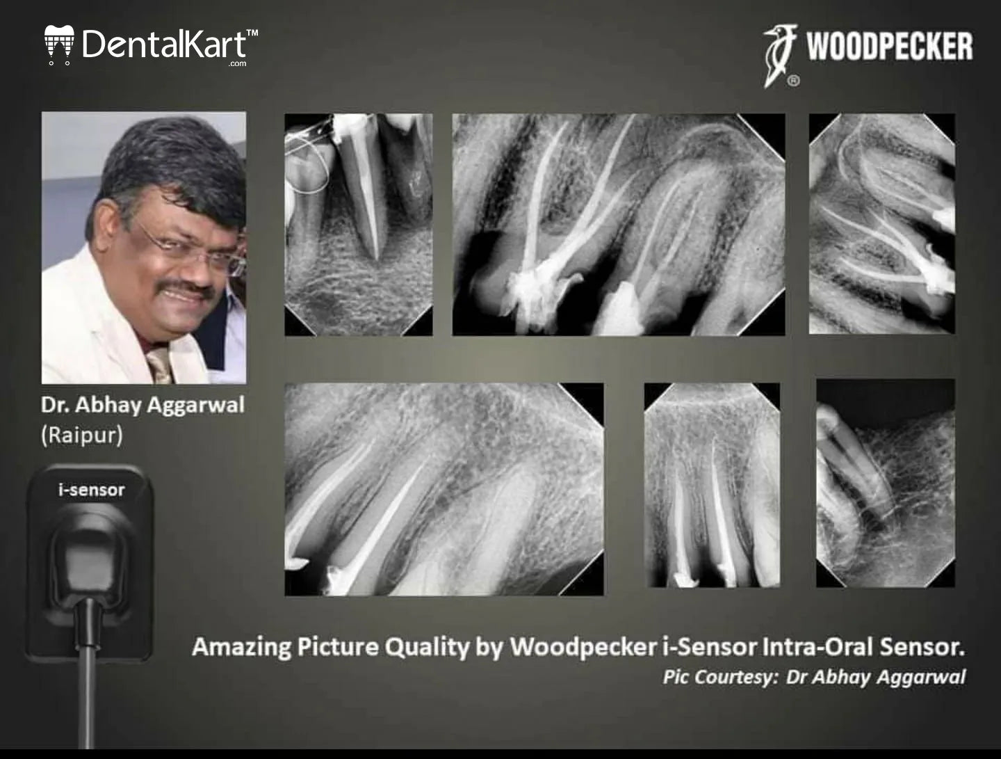 WOODPECKER RVG I-SENSOR SIZE 1