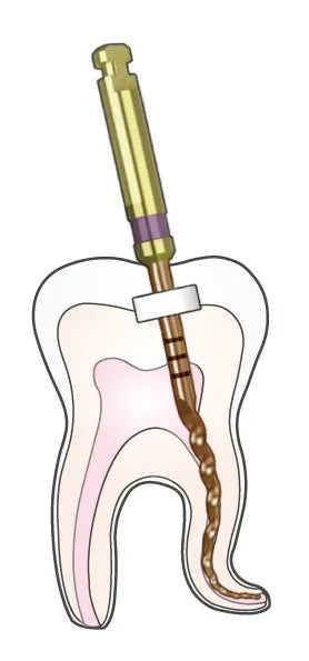 Woodpecker Endo Plus rotary file flexibility demonstration