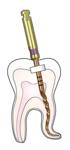 Woodpecker Endo Plus rotary file flexibility demonstration
