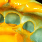 Zhermack Elite HD Putty Soft Fast Set